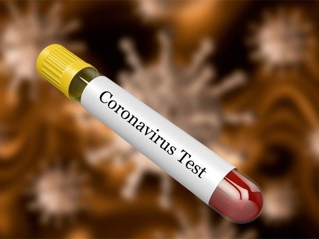 Karachi coronavirus patient’s family cleared of contagious disease