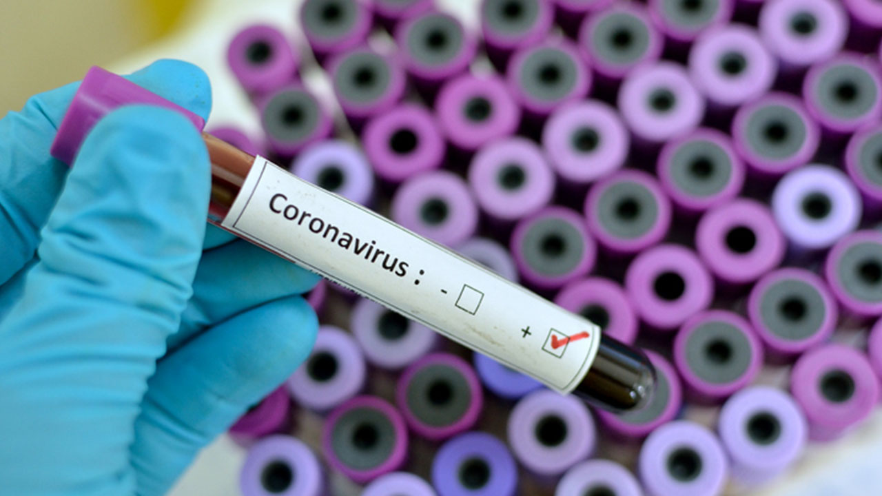 Different stages of the novel coronavirus