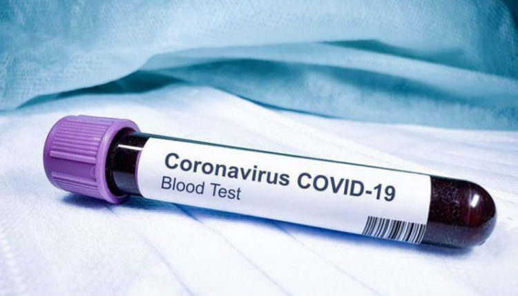 Coronavirus: 10 doctors at Abbasi Shaheed hospital directed to practice self-isolation