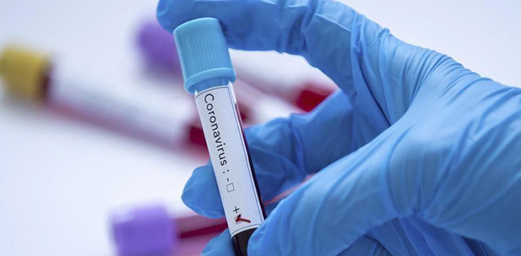 Coronavirus: Death toll in Sindh rises to 5