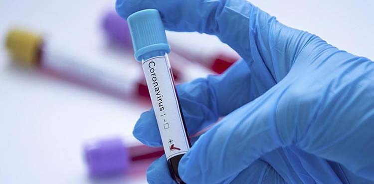 Another Pakistani doctor diagnosed with COVID-19