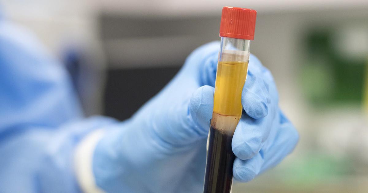 Major victory: First patient to undergo Plasma Therapy in Sindh defeats coronavirus