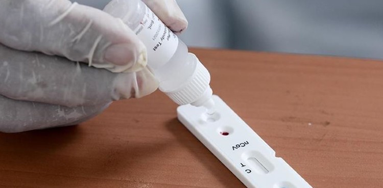 Rapid Antigen Testing