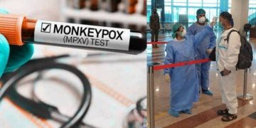 WHO investigating with Government of Pakistan on Monkeypox