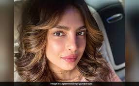 Priyanka Chopra drops three movies due to botched facial surgery