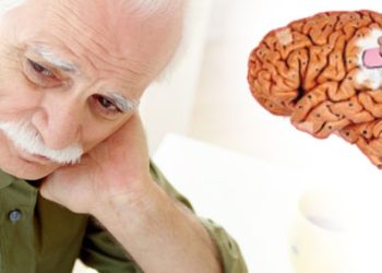 US makes new Alzheimer’s drug more widely accessible