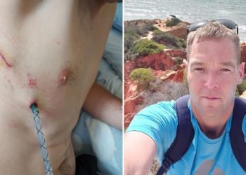 Dad-to-be’s lung collapses after vaping for only one month