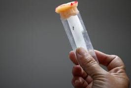 BREAKTHROUGH: First-ever successful dengue fever pill may save millions of lives