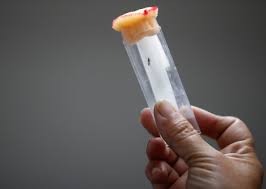 BREAKTHROUGH: First-ever successful dengue fever pill may save millions of lives