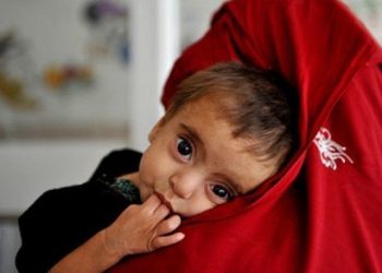 EU reaffirms its commitment to address malnutrition in Sindh