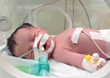Gaza, Miracle baby rescued from womb of dead mother