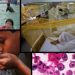 Naegleria claims another life in Karachi as tally rises to 12