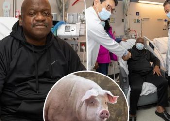 First person to receive pig-kidney transplant dies after 7 weeks