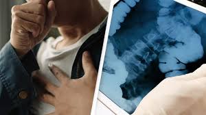 Coughing, sneezing pop man’s colon out of his body