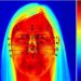 Doctors may use facial temperature for easy diagnosis of metabolic diseases