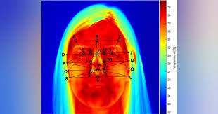 Doctors may use facial temperature for easy diagnosis of metabolic diseases