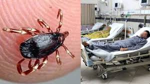 Quetta reports another Congo virus case