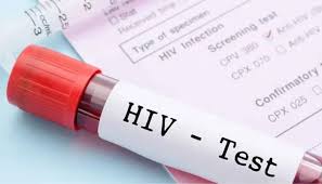 Mirpurkhas emerges another hotspot district for HIV in Sindh