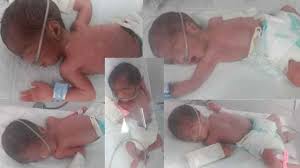Quintuplets born to woman in Karachi